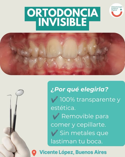 Tratamiento de ortodoncia invisible